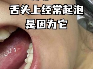 为什么舌头探洞时水会好多？如何应对这种情况？