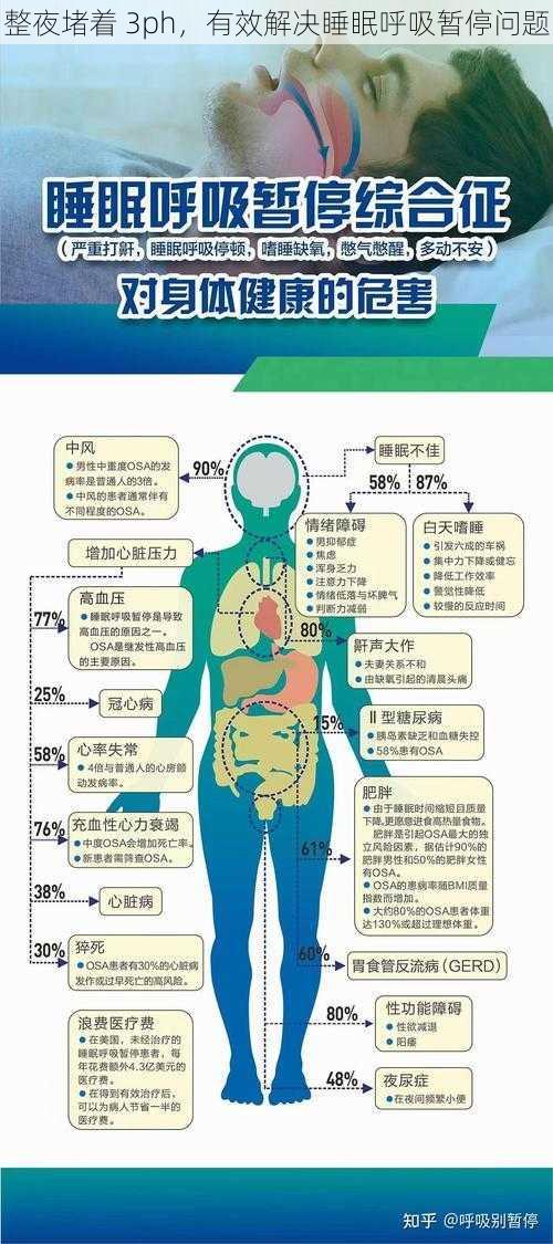 整夜堵着 3ph，有效解决睡眠呼吸暂停问题