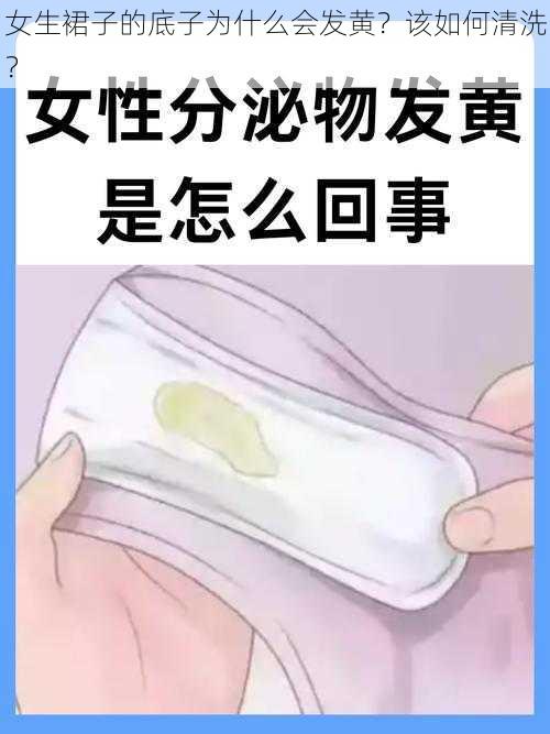 女生裙子的底子为什么会发黄？该如何清洗？