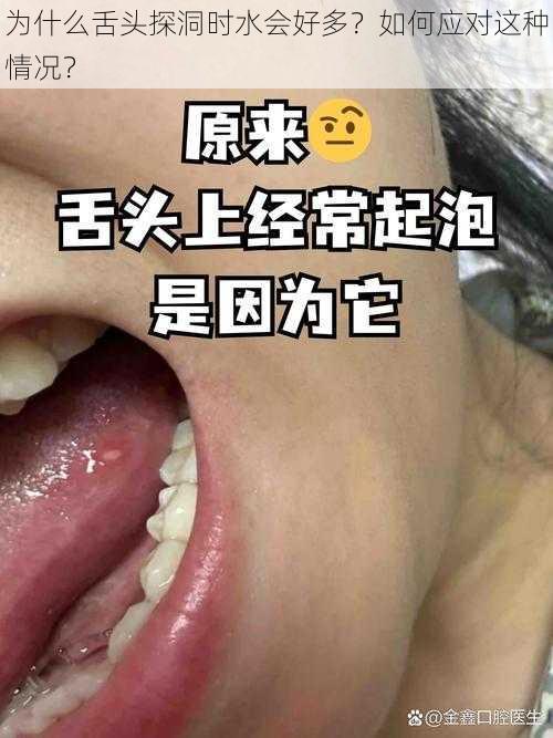 为什么舌头探洞时水会好多？如何应对这种情况？